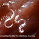 Illustration for article titled How to Kill a Parasitic Worm Living Inside of You